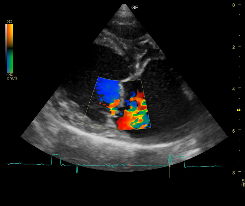 循環器科疾患について