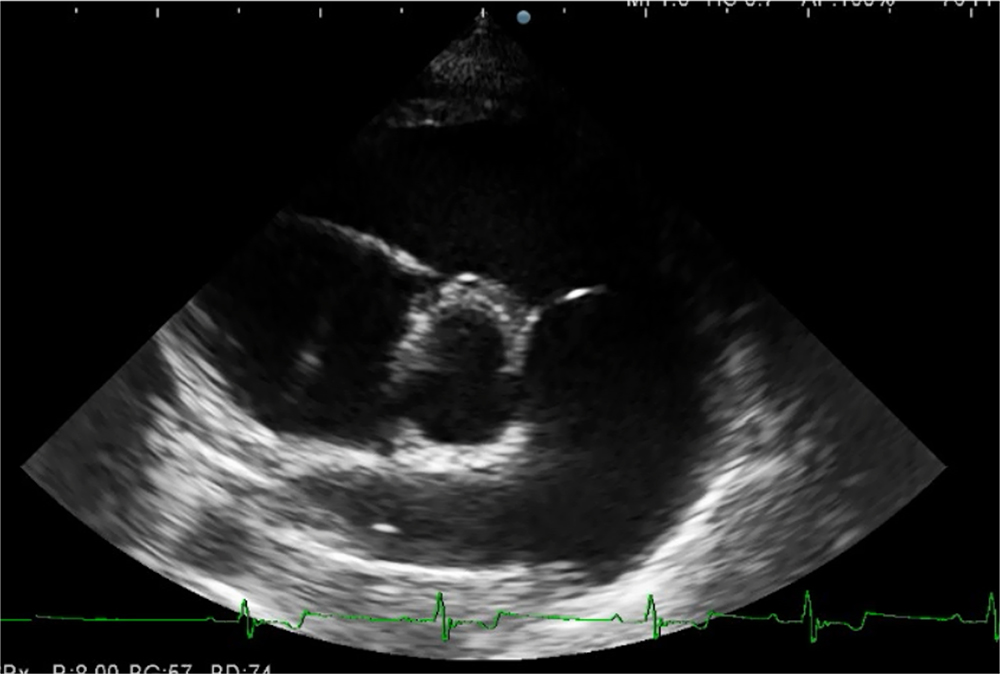 犬の肺高血圧症