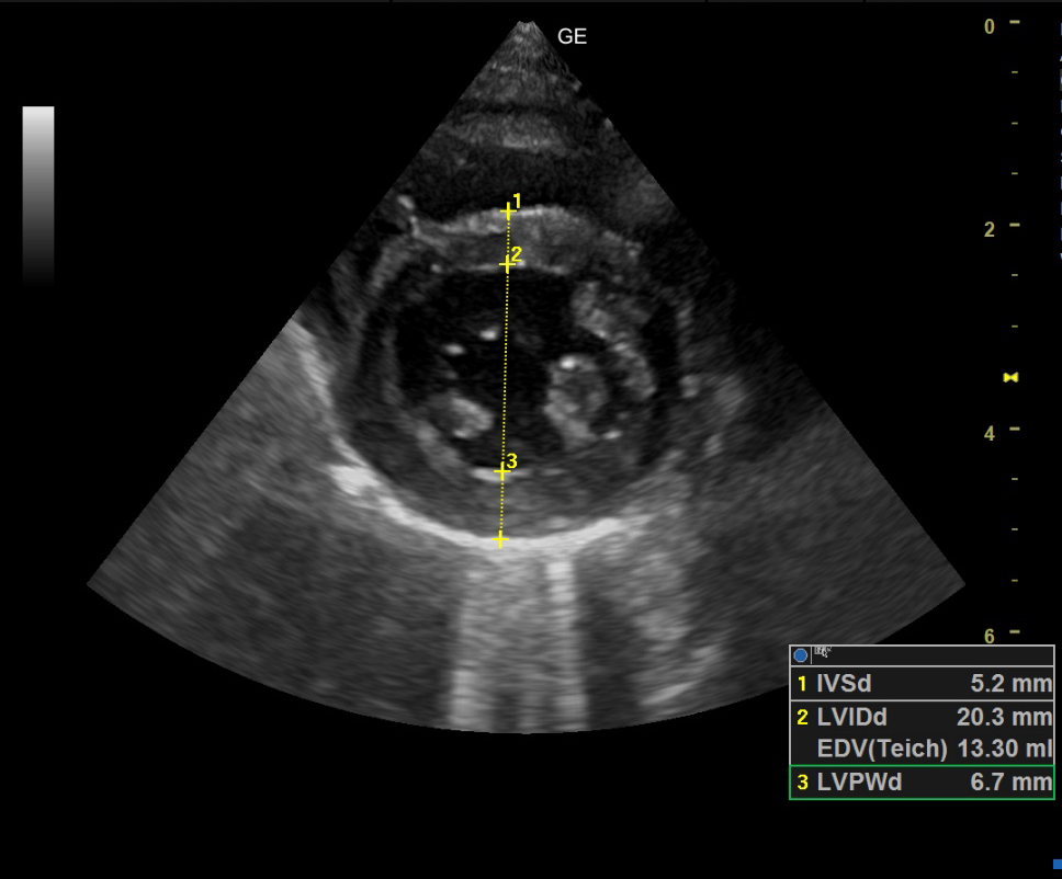 猫の肥大型心筋症