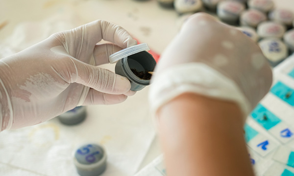 糞便検査・尿検査