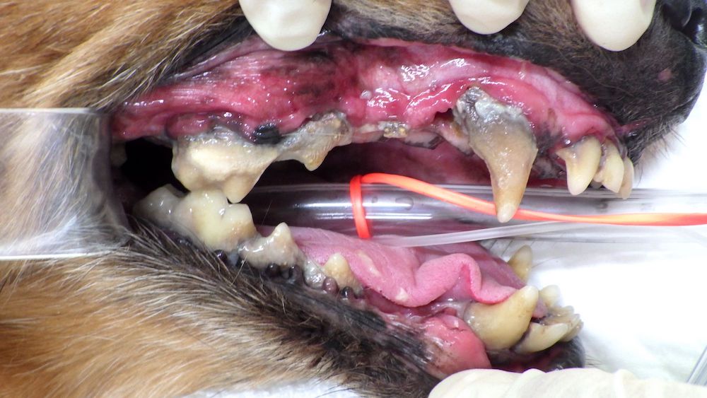 重度歯周病 + 口鼻腔瘻