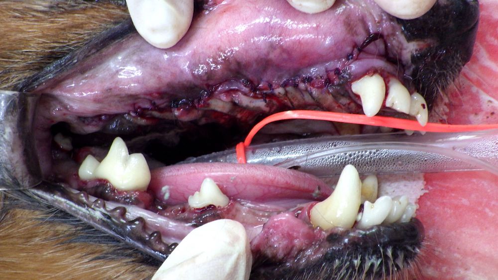 重度歯周病 + 口鼻腔瘻