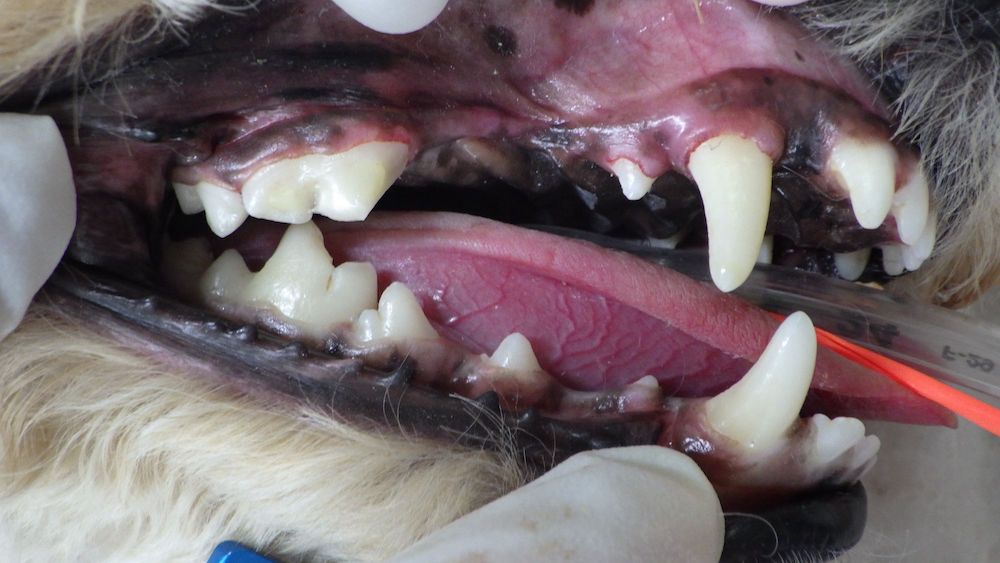 複雑性破折 + 露髄