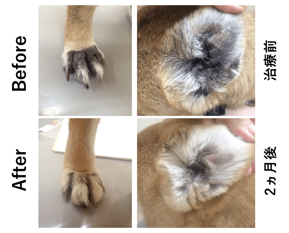 アトピー性皮膚炎の治療前と治療後の耳と手の比較