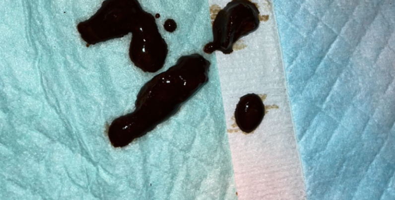 正常ではない便