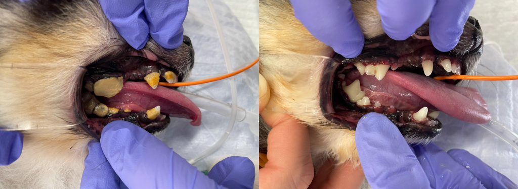 歯科処置前と歯科処置後の写真