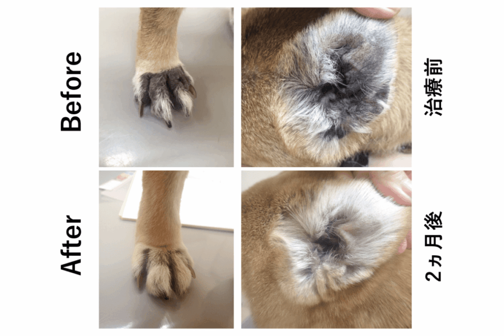 アトピー性皮膚炎の治療前と治療後の耳と手の比較